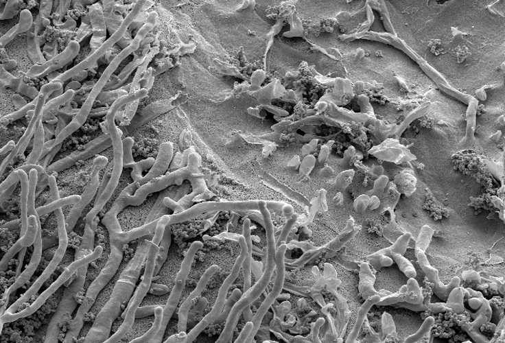 micro-sem-fungus-on-plastic2