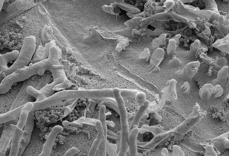 micro-sem-fungus-on-plastic3