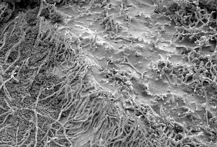 micro-sem-fungus-on-plastic1